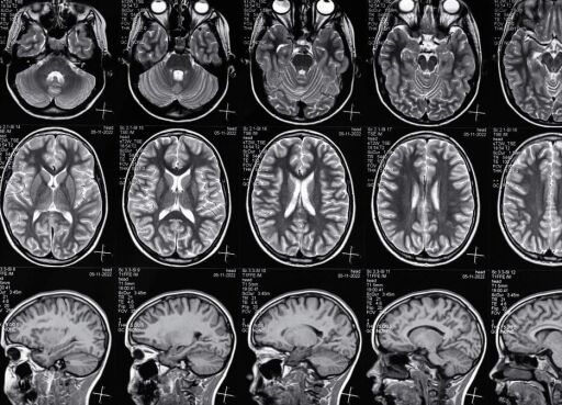 What causes traumatic brain injuries? Traumatic brain injuries can be caused by sudden injuries to the head, including in car accidents.